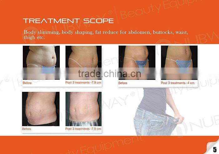 2014 newest high intensity focused ultrasound hifu