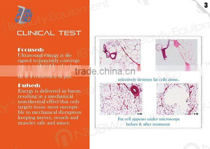 2016 newest high intensity focused ultrsound slimming HIFUSHAPE Hifu