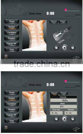 slimming body fine contouring shape FB F017