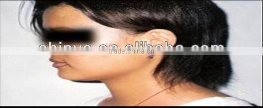 1064nm&532nm Q-switch Nd:YAG laser machine