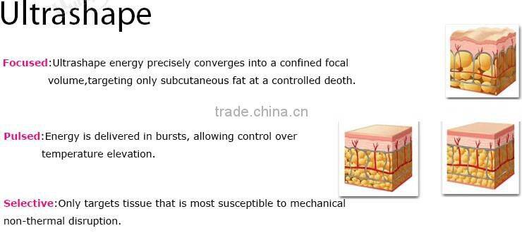 Ultrashape's unique pulsed for Ultrashape Slimming Machine/ Hifu Slimming Machine OEM/ODM