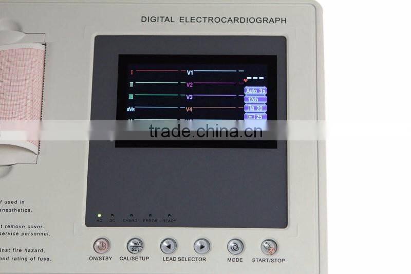 CE approved Three channel color LCD display 12-lead Built ECG Machine in USB/RS232 interface