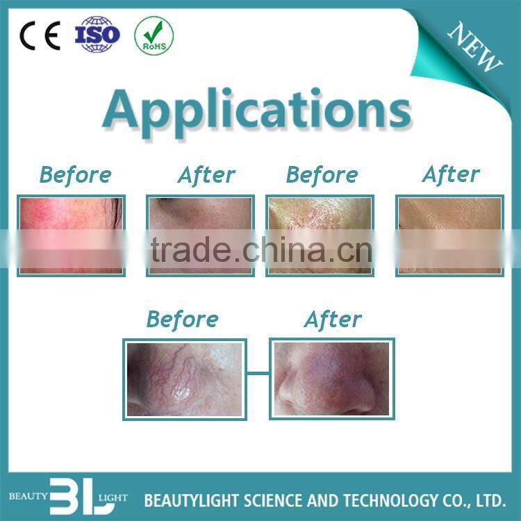 Good quality red blood purify machine machine ARES-R CE