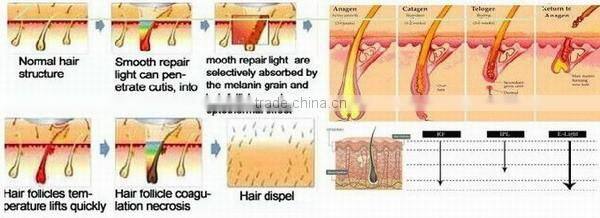 High quality ABS housing 10 shots/second ipl shr hair removal multi mode for choose competitive price