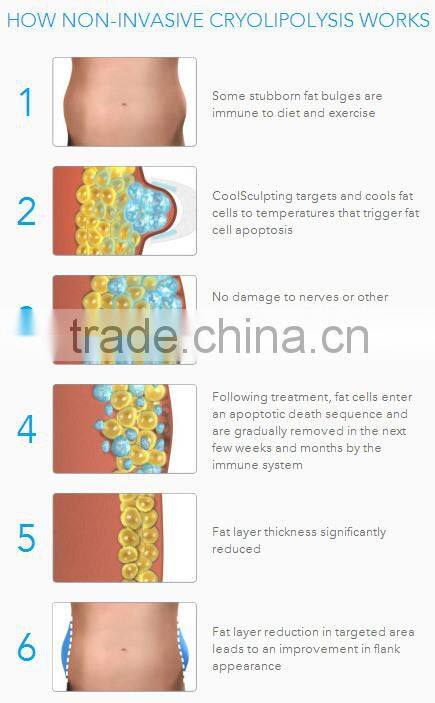 NEWS! Sales Promotion professtional 2 hand pieces Cryolipolysis cryo liposuction machine