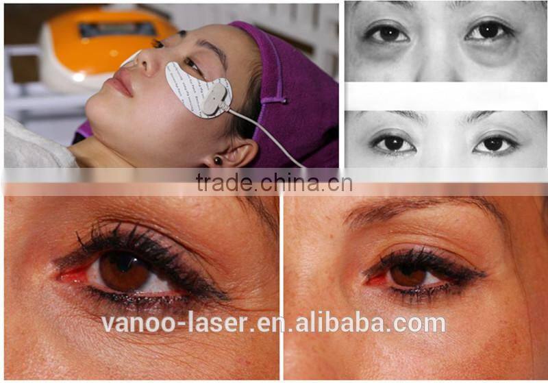 promotion price best skin care eye bag removal mini rf machine personal care