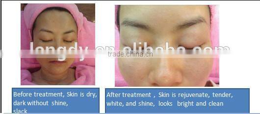 protable skin lifting, tightening, wrinkle removal ultrasound +BIOskin beauty device