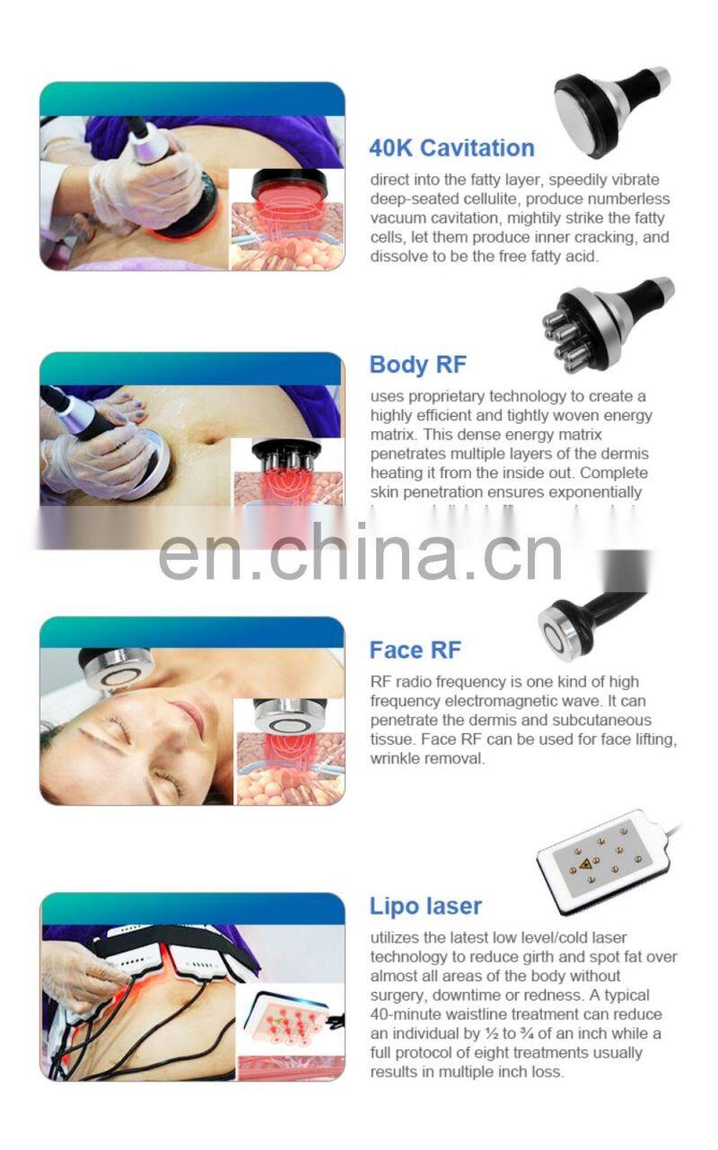 2021 new arrivals cryolipolysis 360 five handles+laser pad+40K cavitation+rf function