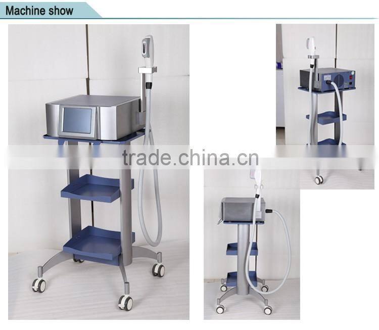 2017 Hottest portable high intensity focused ultrasound wrinkle removal with CE Approved