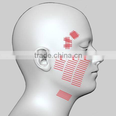 2016 hot sale hifu machine wrinkle removal/body slimming machine for home use