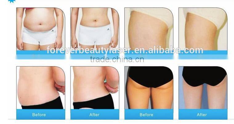 CE Certification portable Laser+Cavitation+RF slimming hot sale machine