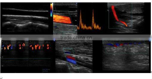 3D and 4D Color Doppler with 4D Real Time Live Probe iSpark 480plus/option Trans-vaginal Array Probe (180)