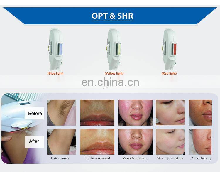 Guangzhou Renlang skin tightening RF tattoo removal laser hair removal IPL lamp