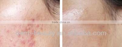 China hot-selling mesotherapy needle machine