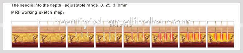 On promotion discount product microneedle fractional rf skin tightening machine