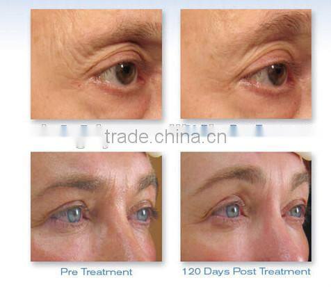 Water Oxygen generator For facial cleaning Salon Machine