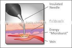 factory price best beauty device / facial veins removal / laser varicose veins treatment