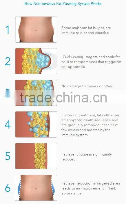 Portable Weight loss equipment slimming cryo fat freezing cryolipolysis machine for home use with 5 treatment handles