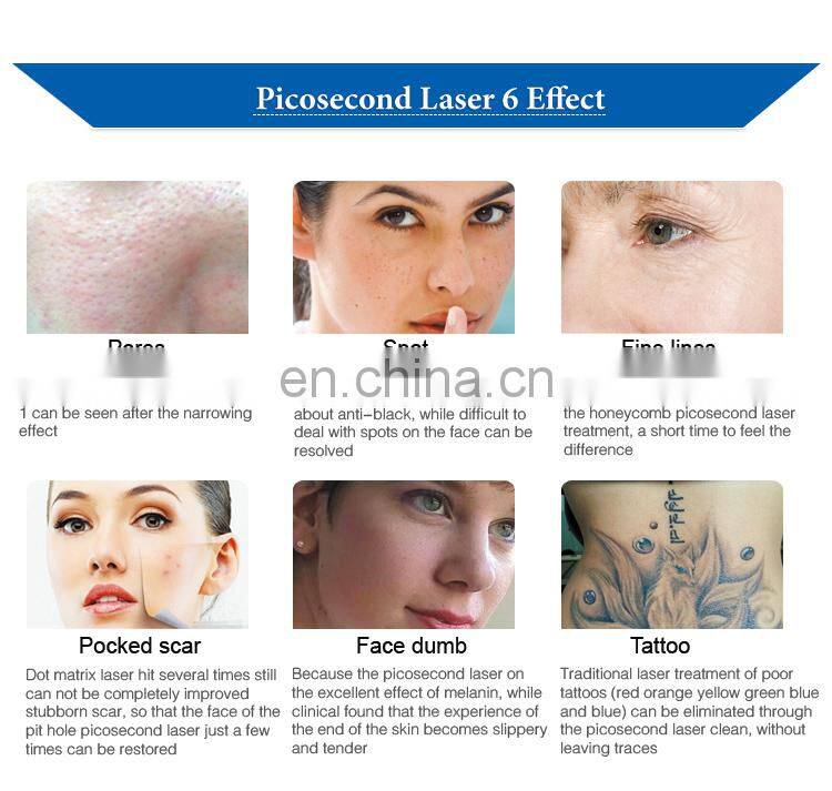 Low price portable 755nm honeycomb lenses pico laser