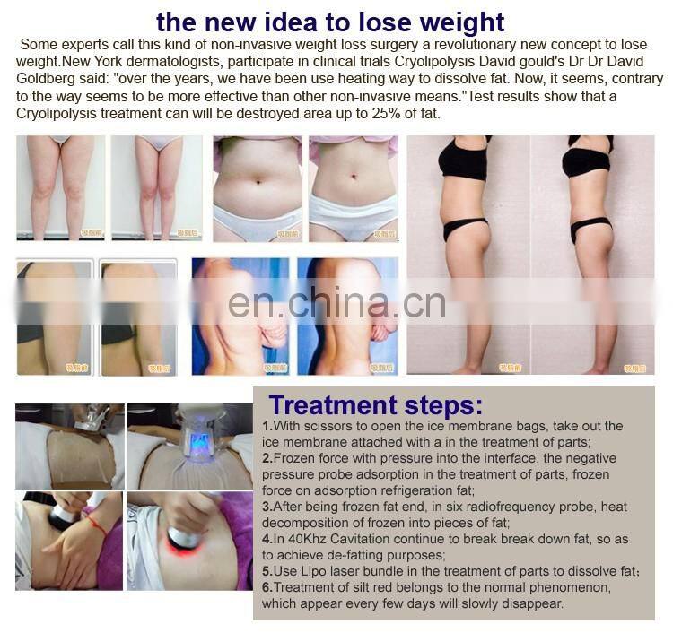 Portable 4 in 1 cryolipolysis fat freeze slimming machine for sale/cavitation rf machine/Lipo laser