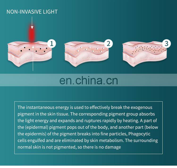 Factory Non Invasive Tattoo Removal Laser Instrument Q Switch ND Yag Laser Machine Eyebrow Pigment Removal Beauty Instrument