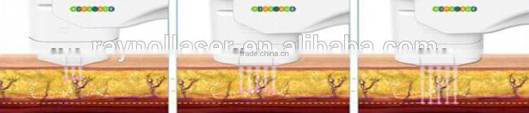 HIFU Facial Beauty Machine for Face lift Brow Lift