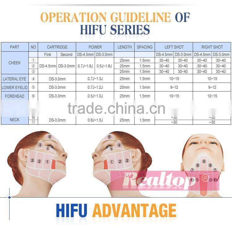 Distributor opportunities non invasive and painless smas tightening technology anti-aging wrinkle removal ultra lift hifu facial