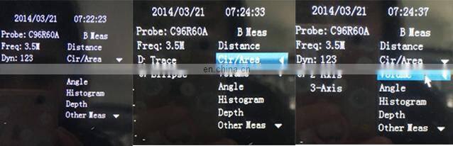 HC-A003 Cheap Full digital laptop veterinary ultrasound scanner machine