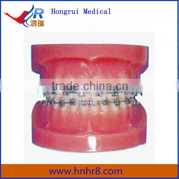 Hot Sale Medical Teeth Fixed Orthodontic Model (Normal)