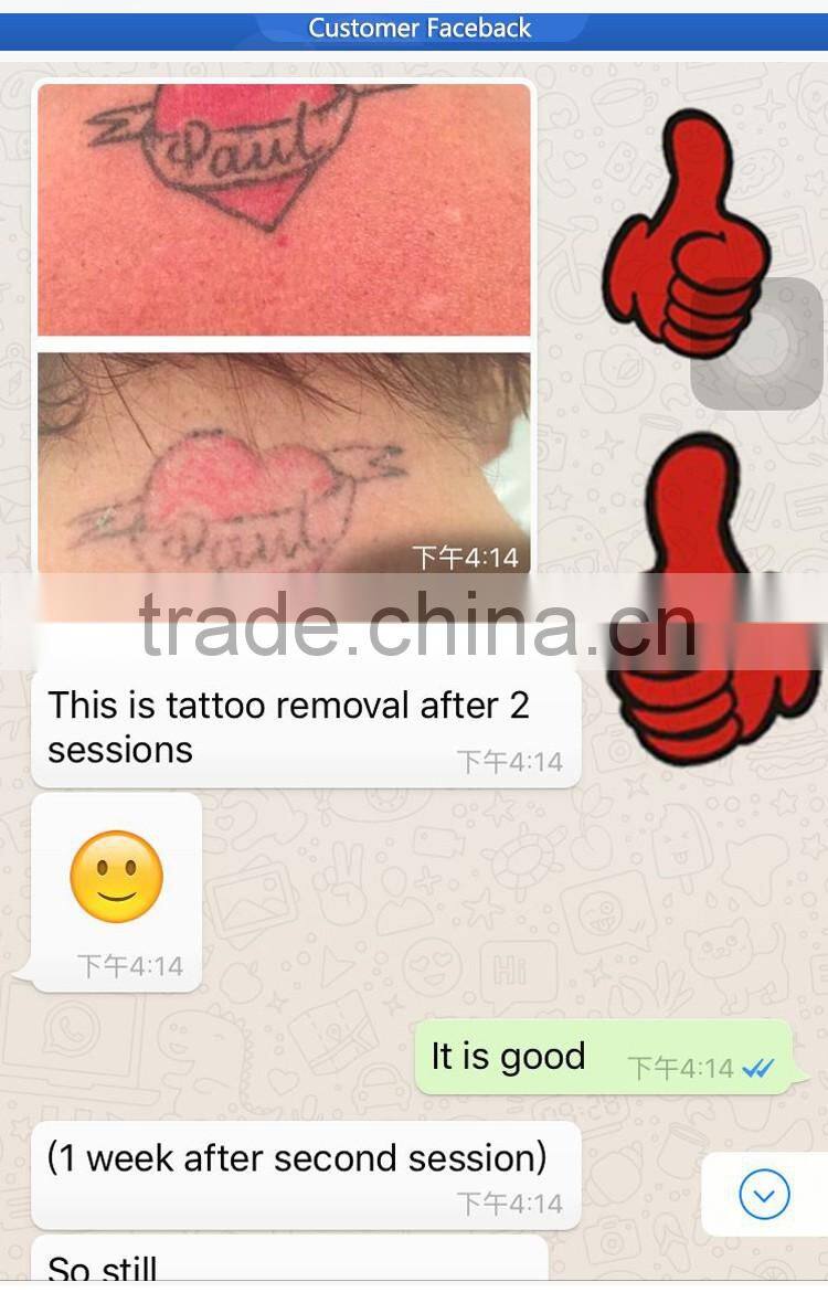 Newest Q switch nd yag laser for tattoo removal for sale