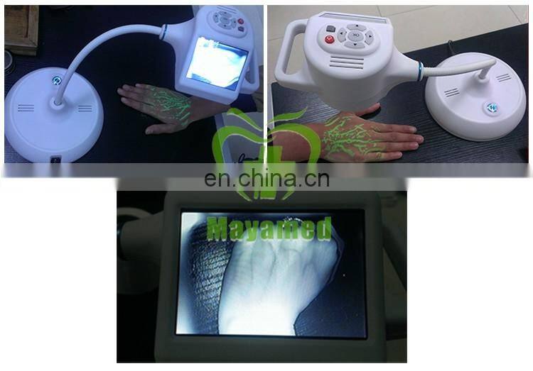 MY-G061 Hot sale Infrared angiograph / Medical Portable vein finder