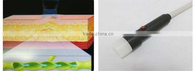 portable ultrasound cavitation fat reduction machine