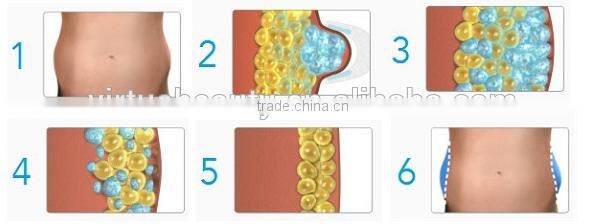 Wonderful!MINI homeused Cryo lipolysis fat freeze pad for weight loss