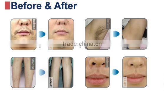 diode laser nono hair removal machine with CE