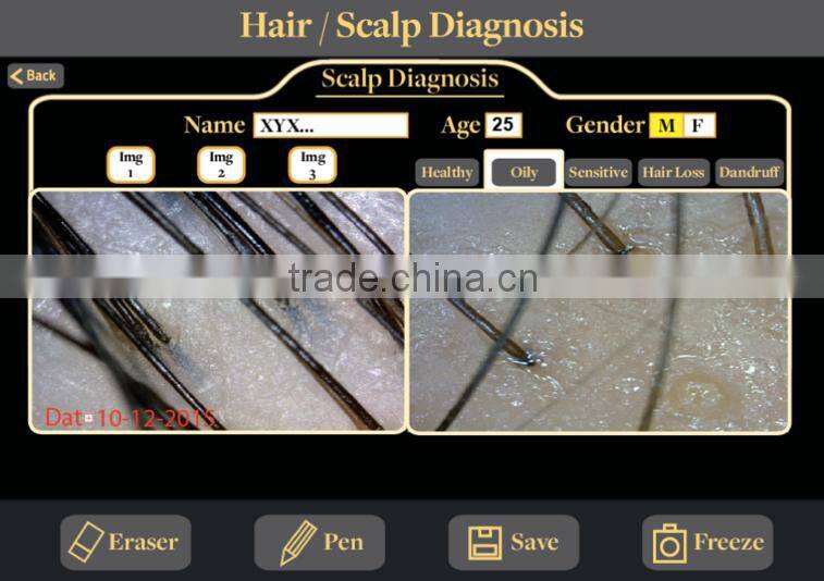 hair analysis machine in Skin Analyzer hair analysis equipment