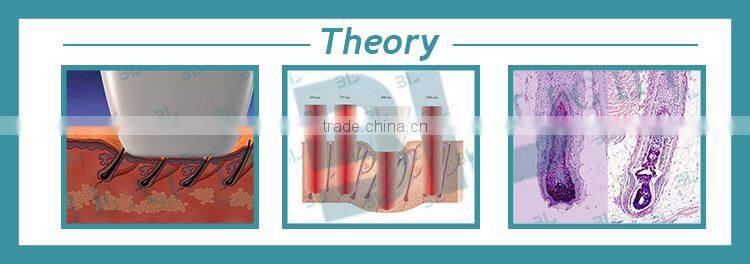 808nm diode laser hair removal machine, laser hair removal best machine, hair removal