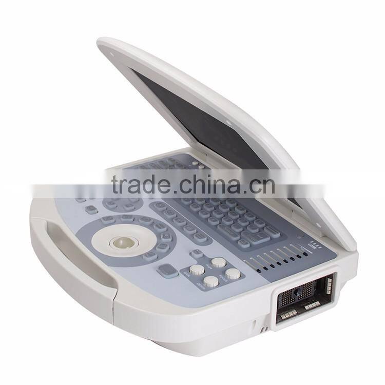 Medical Devices digital Clear Imaging portable ultrasound machine for pregnancy