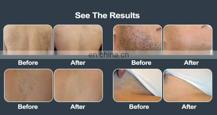 Salon Beauty Equipment Epilator hair removal machine 808nm diode laser machine from alibaba best sellers products