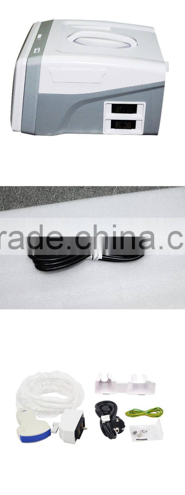 High Quality Ultrasound Machine Medical equipment ultrasound machine portable