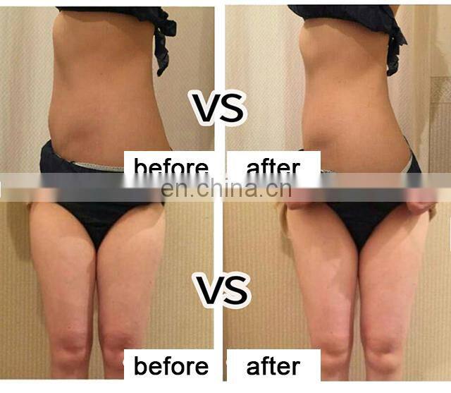 2018 New Beauty Equipment Vmax Cartridge Ultrasound Body Slimming Machine