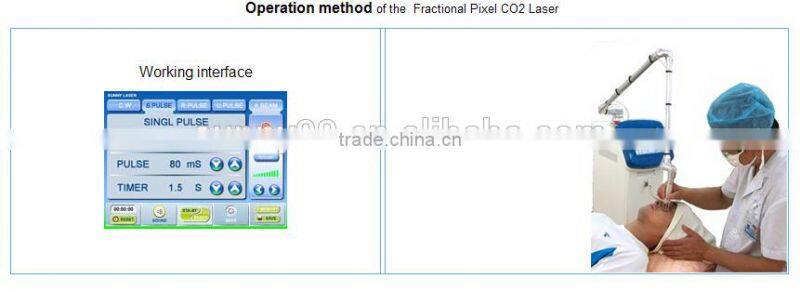 CO2 pixel laser for beauty salon/ Pixel laser /Pixel laser Co2 machine