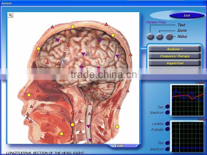 2016 Best selling 3d nls quantum resonance magnetic body health analyzer