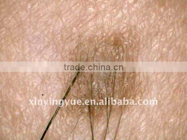 Portable USB link skin /hair analyzer