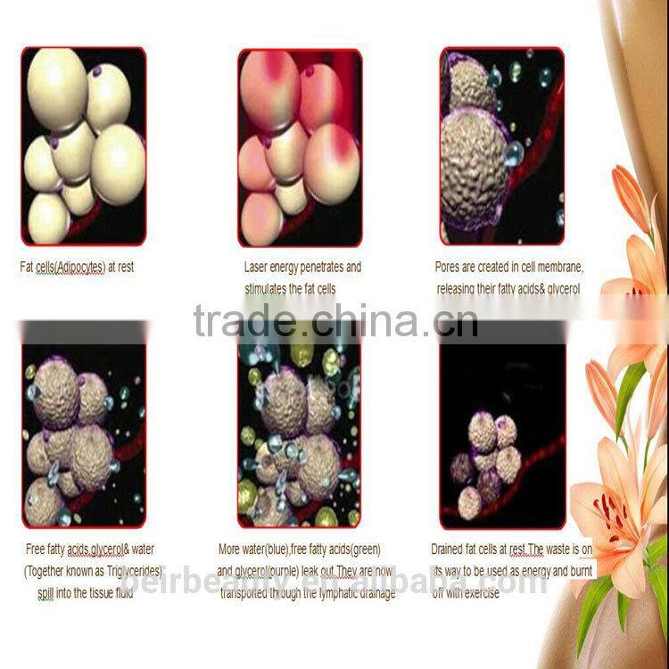 lipo laser / 408 diodes lipolaser slymming machine/ cold lipolaser diode slimming