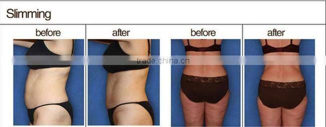 Apolo bipolar rf skin rejuvenation beauty machine