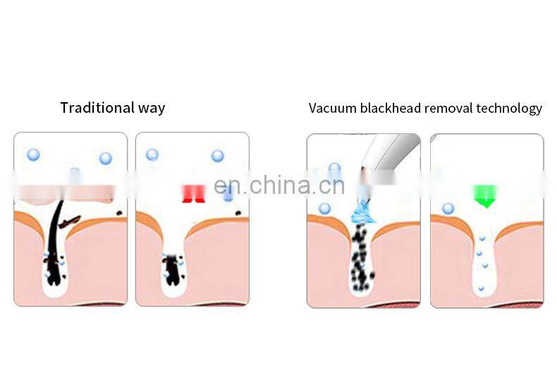 Free Sample Blackhead Remover Set Electric Microdermabrasion Machine with 6 Replacement Probes to Clear Acne Comedone