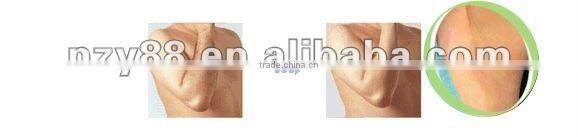 2012 best mini hair removal diode laser machine