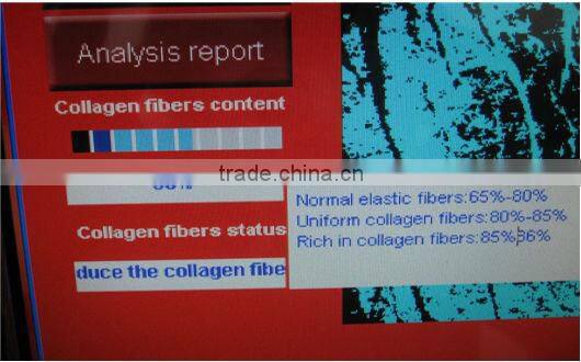 Most advanced auto-digital high quality smart portable skin analyzer