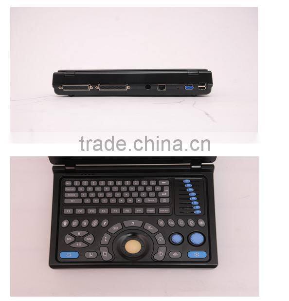 Full Digital Laptop Ultrasound Scanner(PC)
