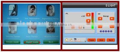 real 2000W 2 in 1 hair removal skin rejuvenation ipl hair removal elight ipl rf machine